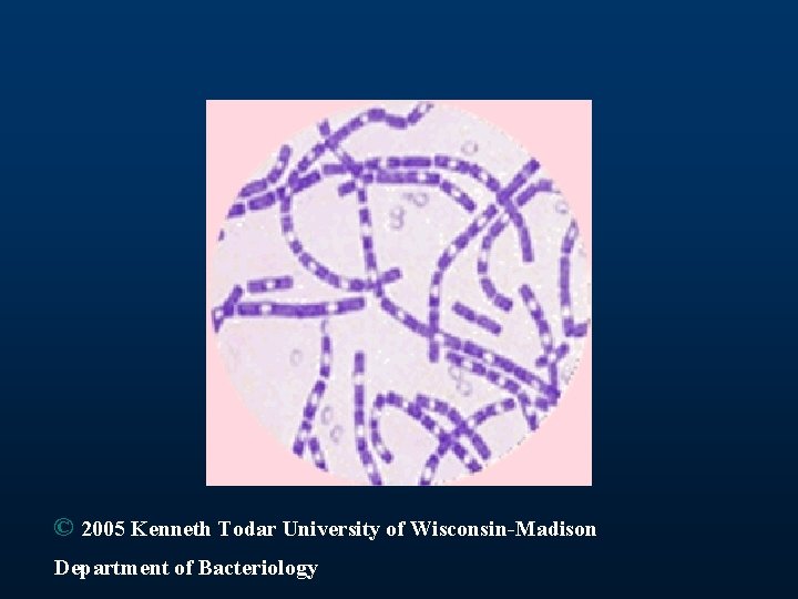 © 2005 Kenneth Todar University of Wisconsin-Madison Department of Bacteriology 