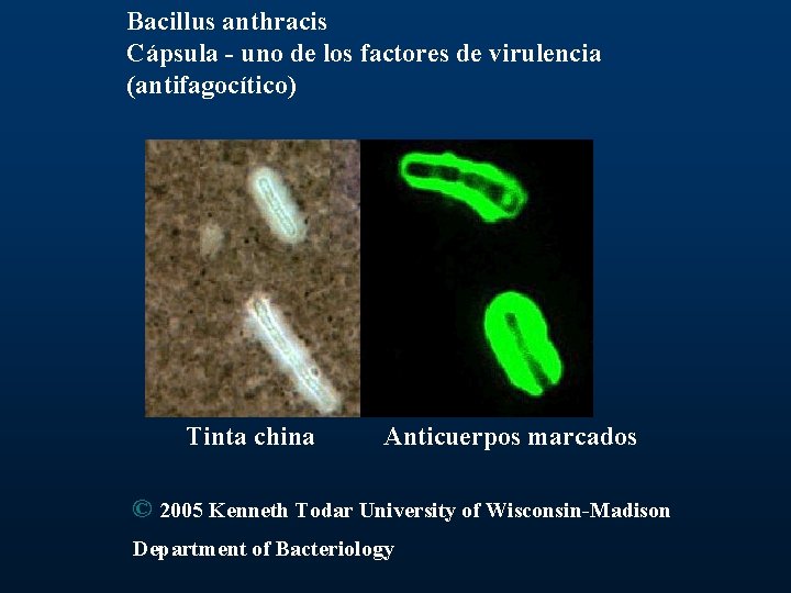 Bacillus anthracis Cápsula - uno de los factores de virulencia (antifagocítico) Tinta china Anticuerpos