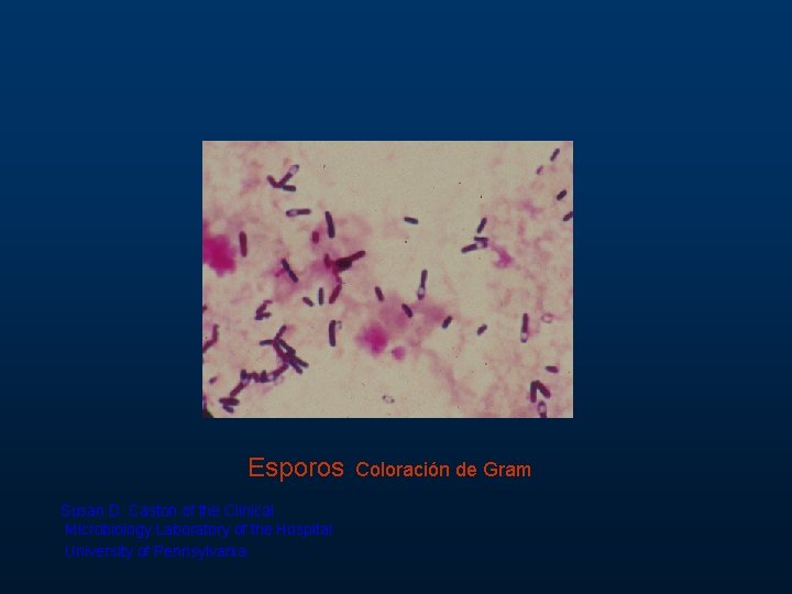 Esporos Susan D. Caston of the Clinical Microbiology Laboratory of the Hospital University of