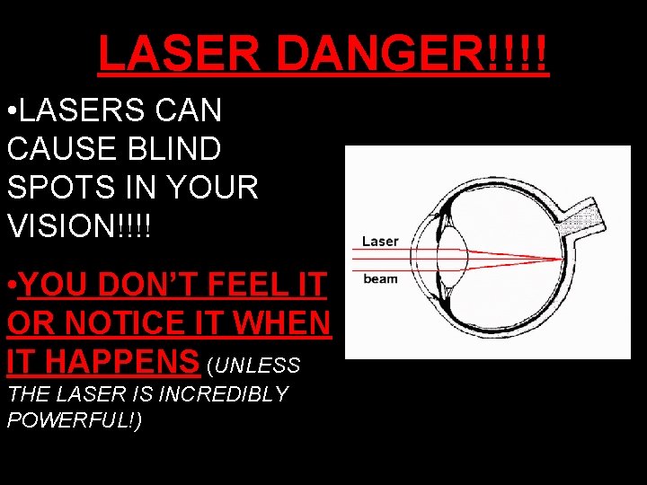 LASER DANGER!!!! • LASERS CAN CAUSE BLIND SPOTS IN YOUR VISION!!!! • YOU DON’T