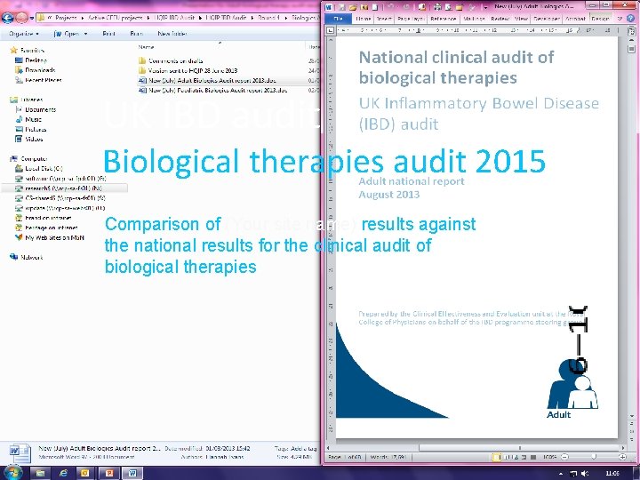 UK IBD audit Biological therapies audit 2015 Comparison of (Your site name) results against