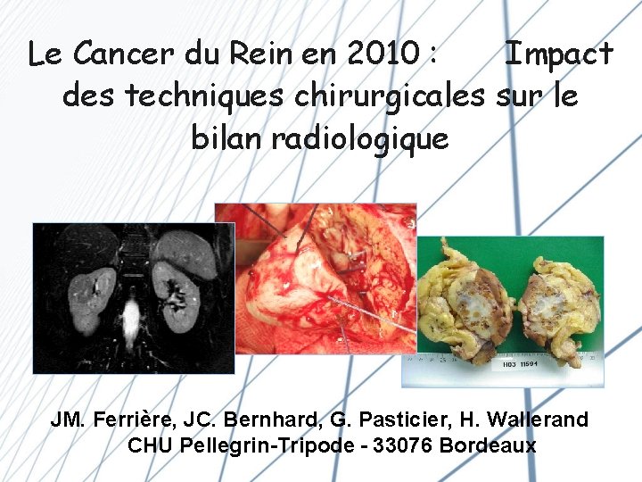 Le Cancer du Rein en 2010 : Impact des techniques chirurgicales sur le bilan