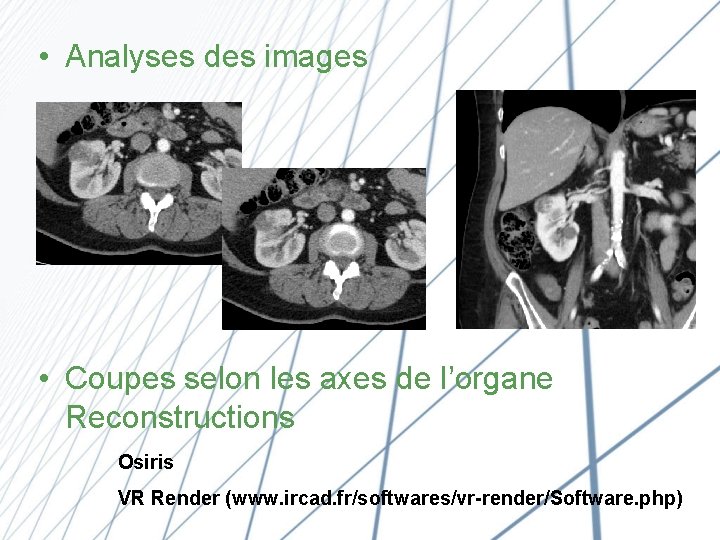  • Analyses des images • Coupes selon les axes de l’organe Reconstructions Osiris