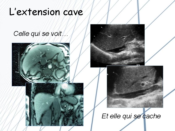 L’extension cave Celle qui se voit… Et elle qui se cache 