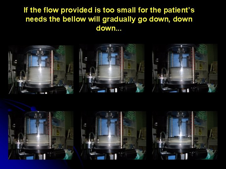 If the flow provided is too small for the patient’s needs the bellow will