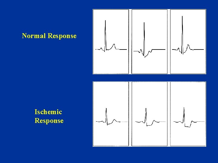 Normal Response Ischemic Response 