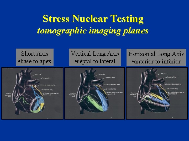 Stress Nuclear Testing tomographic imaging planes Short Axis • base to apex Vertical Long