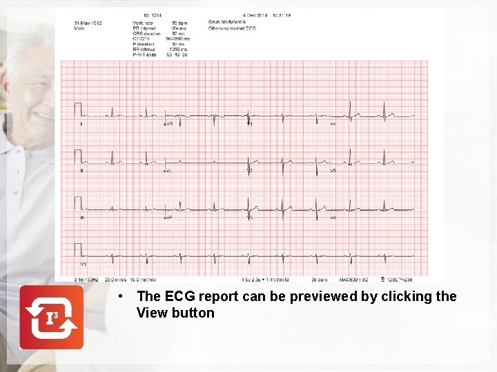  • The ECG report can be previewed by clicking the View button 