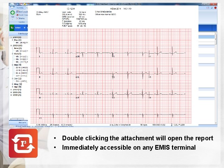  • Double clicking the attachment will open the report • Immediately accessible on