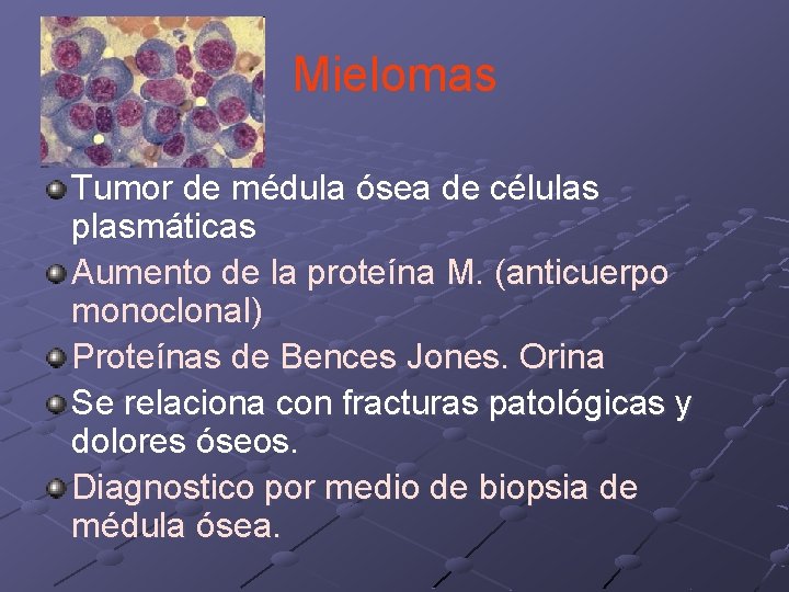 Mielomas Tumor de médula ósea de células plasmáticas Aumento de la proteína M. (anticuerpo Mielomas Tumor de médula ósea de células plasmáticas Aumento de la proteína M. (anticuerpo
