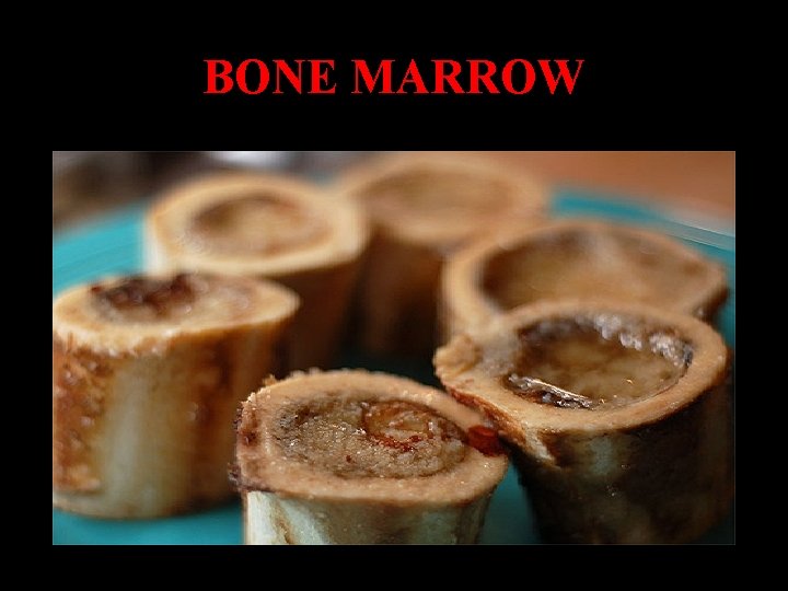 BONE MARROW 