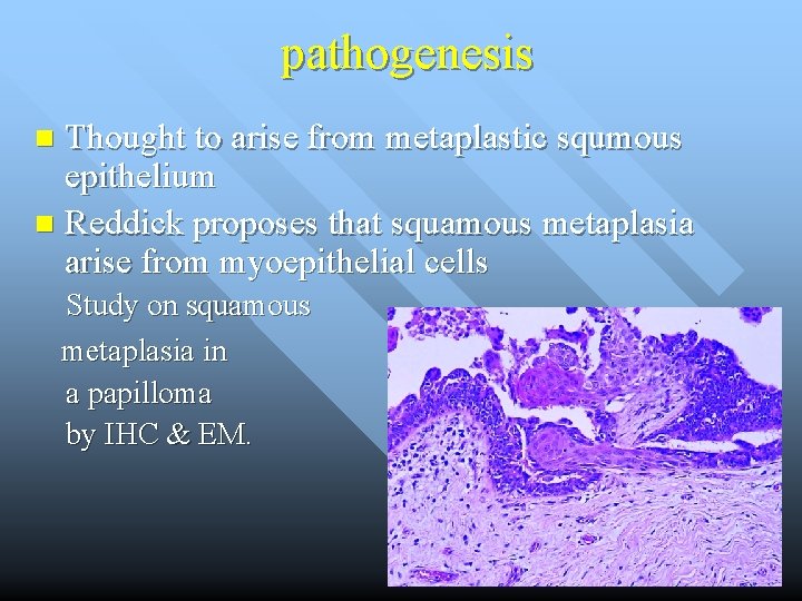 pathogenesis Thought to arise from metaplastic squmous epithelium n Reddick proposes that squamous metaplasia