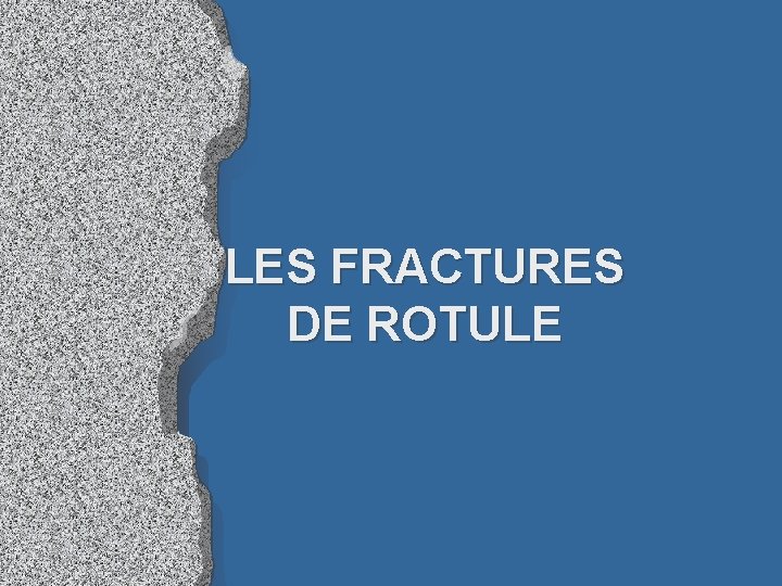 LES FRACTURES DE ROTULE 