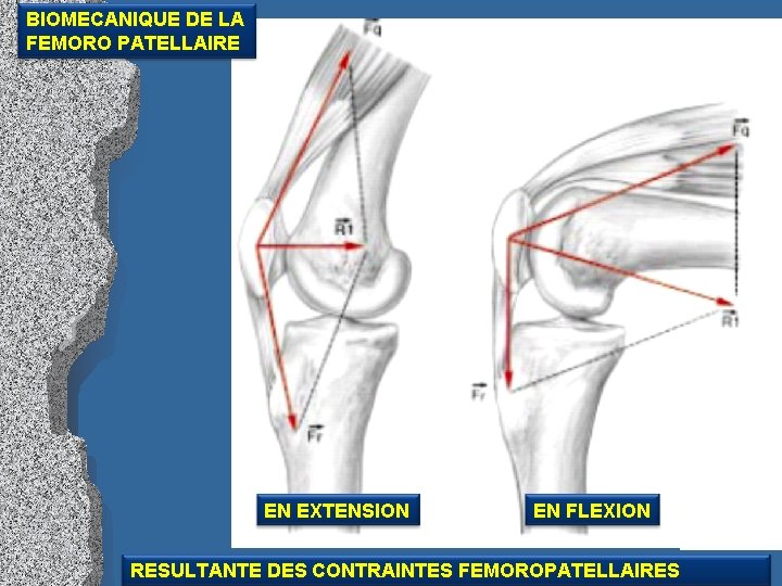 BIOMECANIQUE DE LA FEMORO PATELLAIRE EN EXTENSION EN FLEXION RESULTANTE DES CONTRAINTES FEMOROPATELLAIRES 