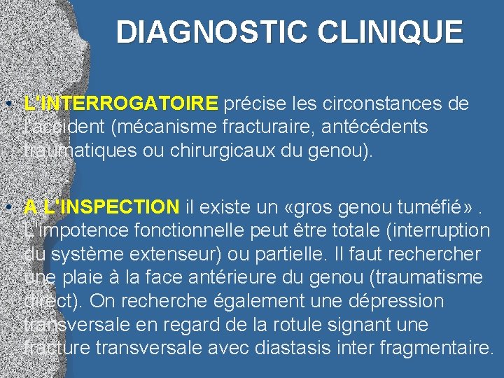 DIAGNOSTIC CLINIQUE • L'INTERROGATOIRE précise les circonstances de L'INTERROGATOIRE l'accident (mécanisme fracturaire, antécédents traumatiques