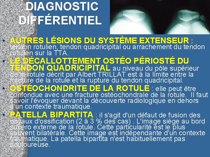 DIAGNOSTIC DIFFÉRENTIEL • AUTRES LÉSIONS DU SYSTÈME EXTENSEUR : : tendon rotulien, tendon quadricipital