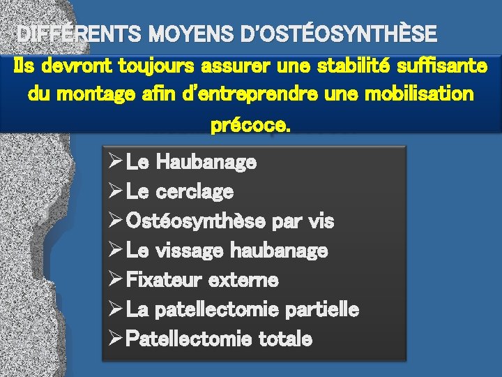 DIFFÉRENTS MOYENS D'OSTÉOSYNTHÈSE Ils devront toujours assurer une stabilité suffisante du montage afin d'entreprendre