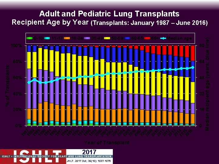 Adult and Pediatric Lung Transplants 11 -17 18 -34 35 -49 50 -59 60