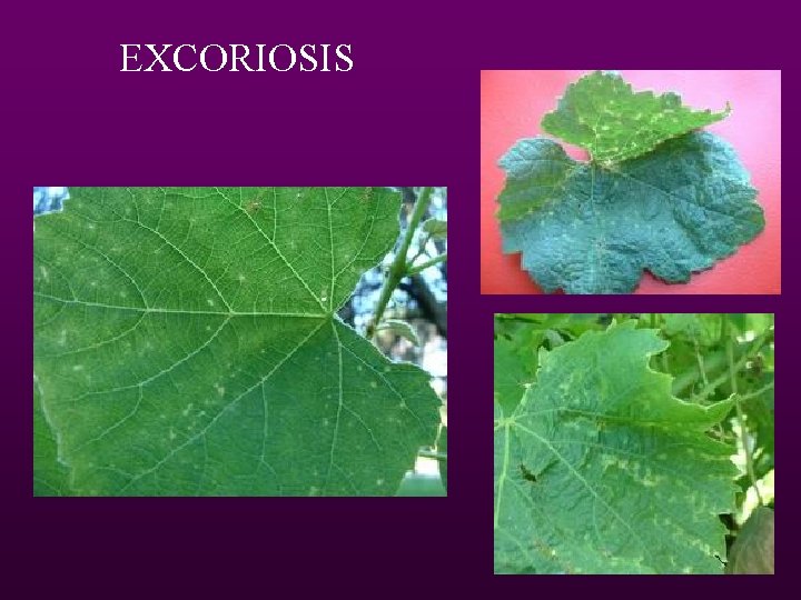 EXCORIOSIS 