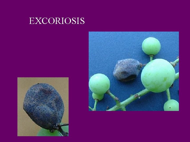 EXCORIOSIS 