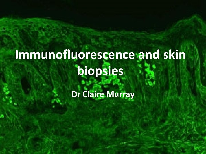 Immunofluorescence and skin biopsies Dr Claire Murray 
