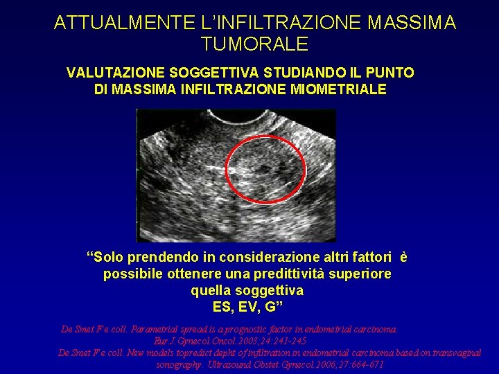 ATTUALMENTE L’INFILTRAZIONE MASSIMA TUMORALE VALUTAZIONE SOGGETTIVA STUDIANDO IL PUNTO DI MASSIMA INFILTRAZIONE MIOMETRIALE “Solo