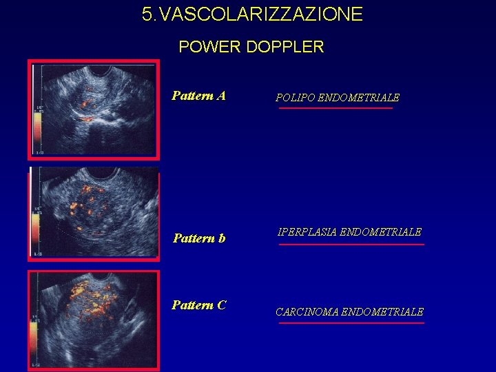 5. VASCOLARIZZAZIONE POWER DOPPLER Pattern A POLIPO ENDOMETRIALE Pattern b IPERPLASIA ENDOMETRIALE Pattern C