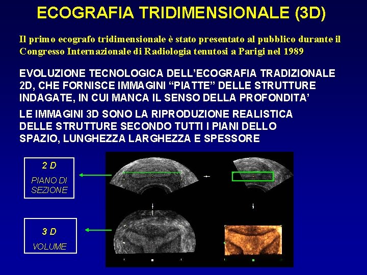 ECOGRAFIA TRIDIMENSIONALE (3 D) Il primo ecografo tridimensionale è stato presentato al pubblico durante