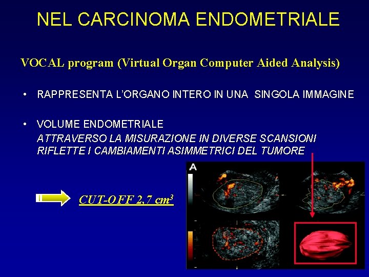 NEL CARCINOMA ENDOMETRIALE VOCAL program (Virtual Organ Computer Aided Analysis) • RAPPRESENTA L’ORGANO INTERO