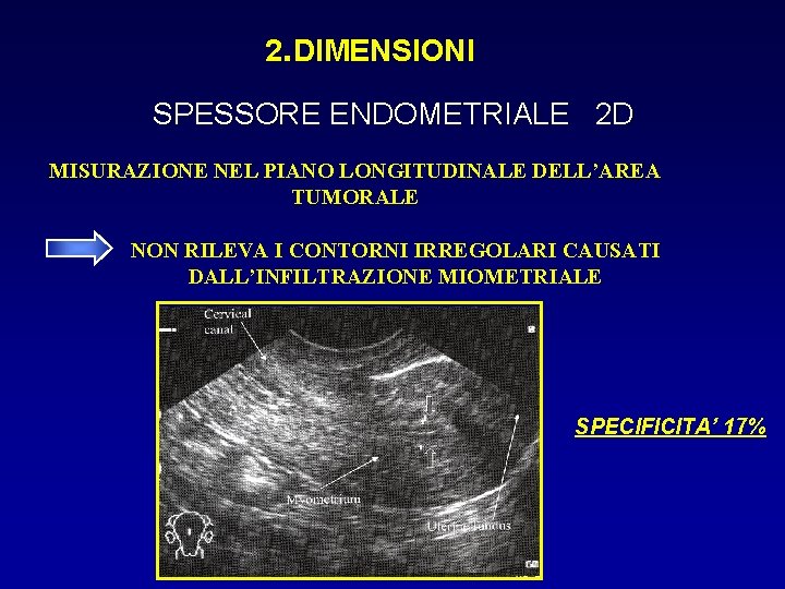 2. DIMENSIONI SPESSORE ENDOMETRIALE 2 D MISURAZIONE NEL PIANO LONGITUDINALE DELL’AREA TUMORALE NON RILEVA