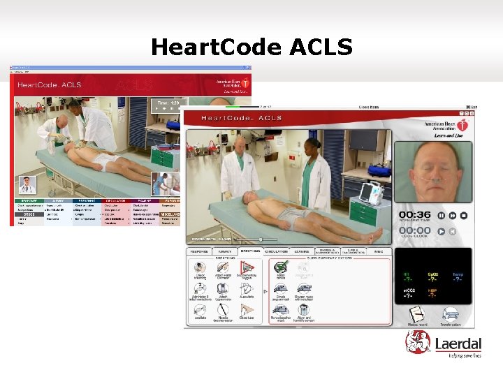 Heart. Code ACLS 