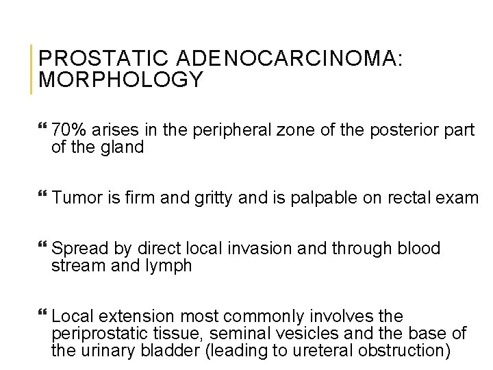 PROSTATIC ADENOCARCINOMA: MORPHOLOGY 70% arises in the peripheral zone of the posterior part of