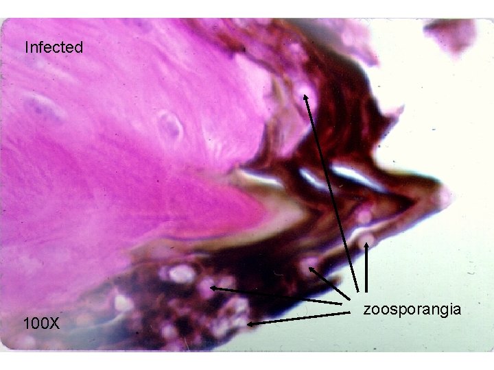 Infected 100 X zoosporangia 