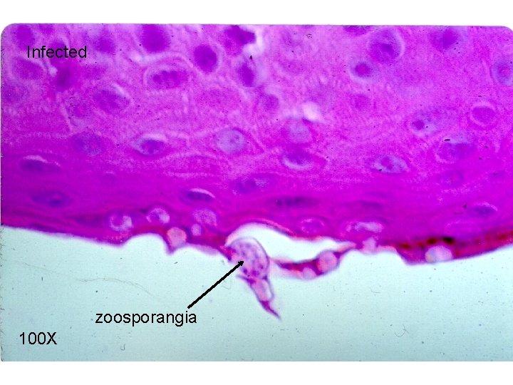 Infected zoosporangia 100 X 