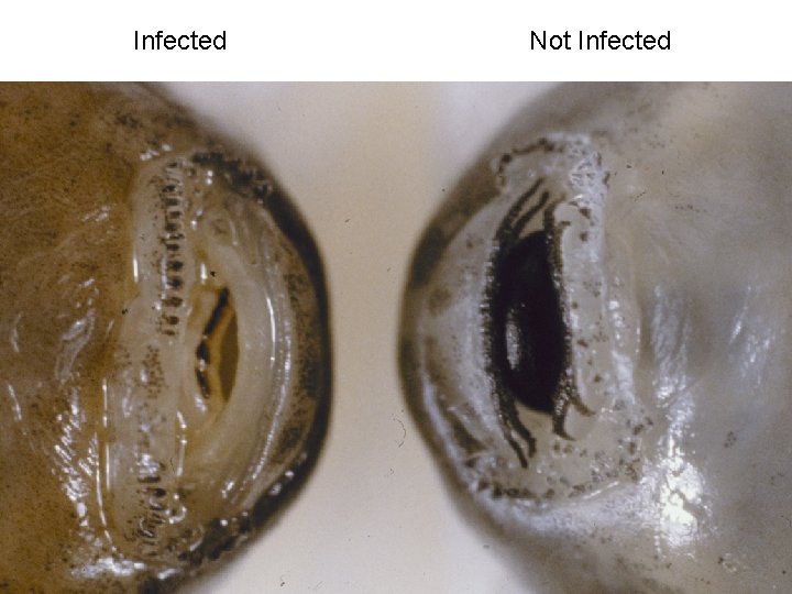 Infected Not Infected 
