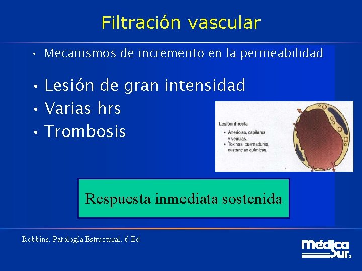 Filtración vascular • Mecanismos de incremento en la permeabilidad • Lesión de gran intensidad