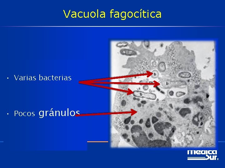 Vacuola fagocítica • Varias bacterias • Pocos gránulos 