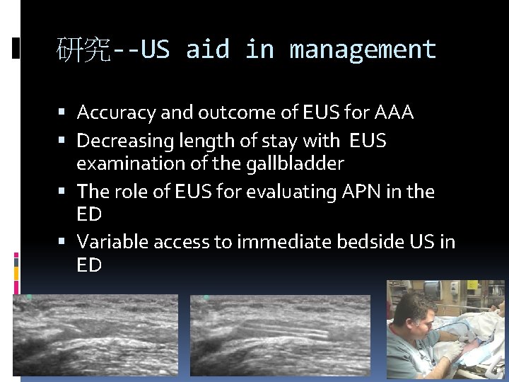 研究--US aid in management Accuracy and outcome of EUS for AAA Decreasing length of