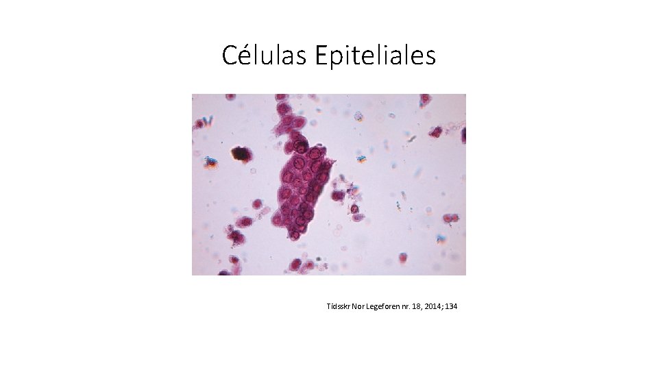 Células Epiteliales Tidsskr Nor Legeforen nr. 18, 2014; 134 