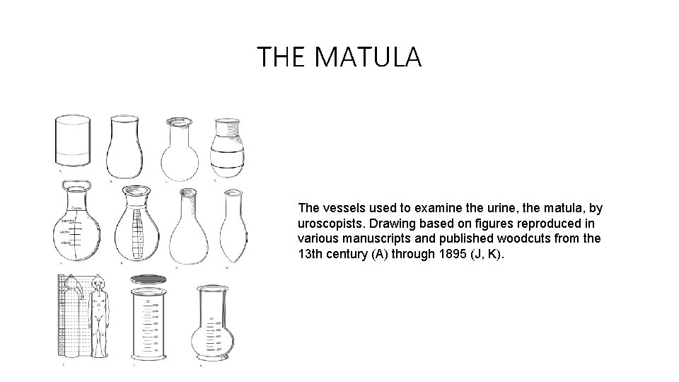 THE MATULA The vessels used to examine the urine, the matula, by uroscopists. Drawing