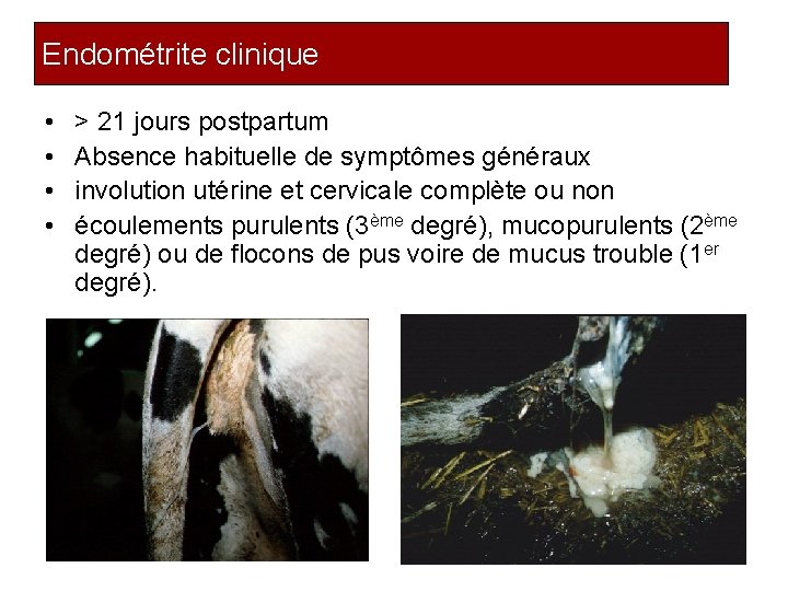 Endométrite clinique • • > 21 jours postpartum Absence habituelle de symptômes généraux involution