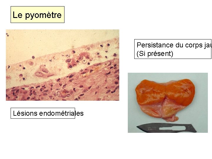 Le pyomètre Persistance du corps jau (Si présent) Lésions endométriales 18 