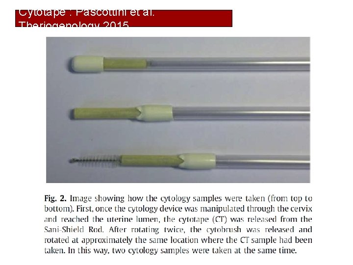 Cytotape : Pascottini et al. Theriogenology 2015 34 