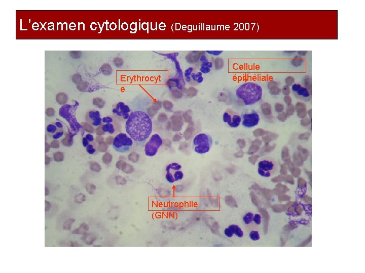 L’examen cytologique (Deguillaume 2007) Erythrocyt e Cellule épithéliale Neutrophile (GNN) Prof. Ch. Hanzen -