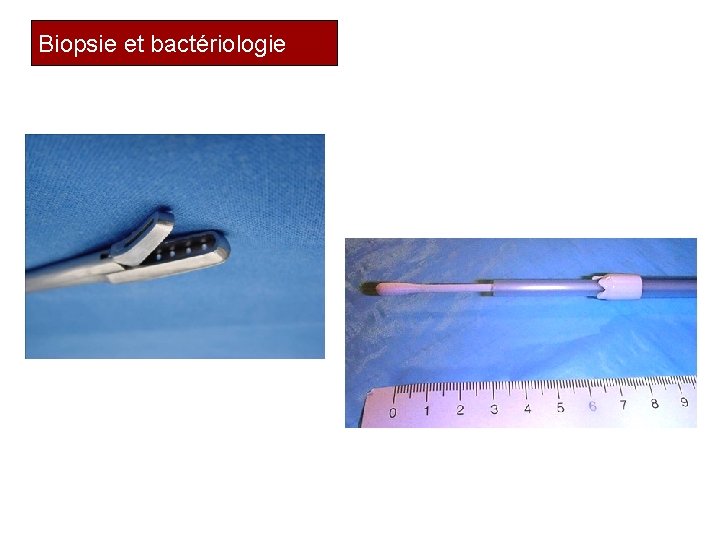 Biopsie et bactériologie 37 
