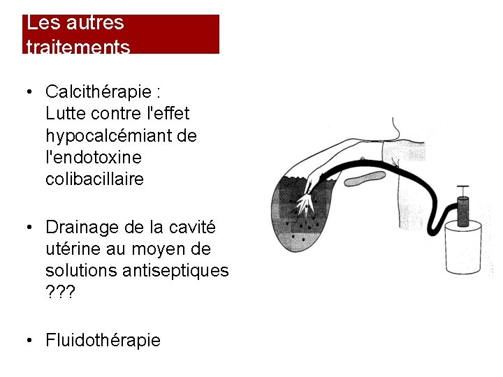 Les autres traitements • Calcithérapie : Lutte contre l'effet hypocalcémiant de l'endotoxine colibacillaire •