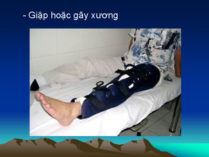 - Giập hoặc gãy xương 