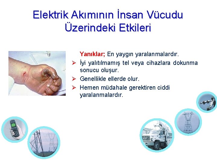 Elektrik Akımının İnsan Vücudu Üzerindeki Etkileri Yanıklar; En yaygın yaralanmalardır. İyi yalıtılmamış tel veya