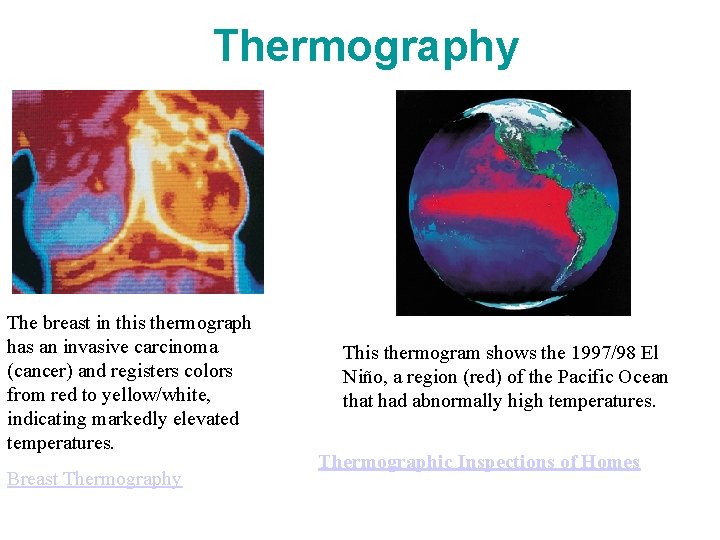 Thermography The breast in this thermograph has an invasive carcinoma (cancer) and registers colors
