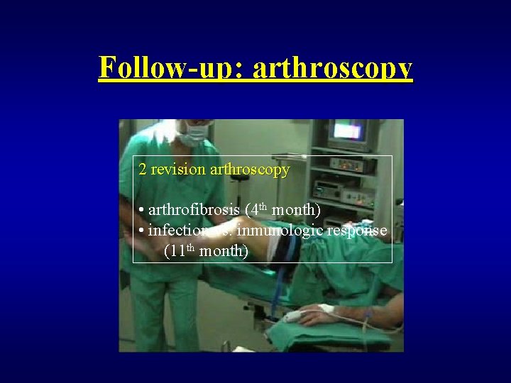 Follow-up: arthroscopy 2 revision arthroscopy • arthrofibrosis (4 th month) • infection vs. inmunologic